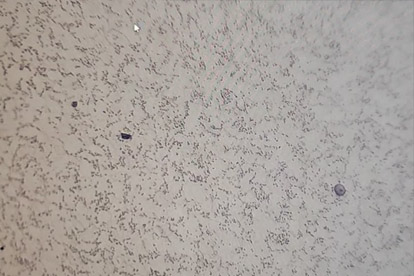 Esame metallografico-500 volte esame metallografico